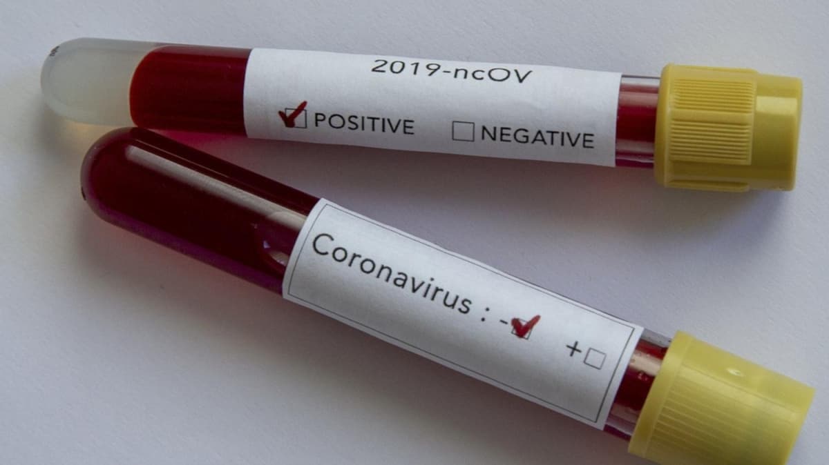 В Бурятии подтверждены 13 случаев коронавирусной инфекции