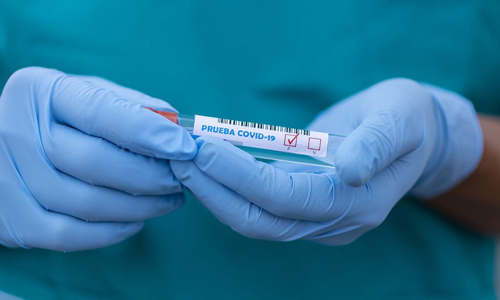 За сутки в Бурятии выявили 19 человек с коронавирусом